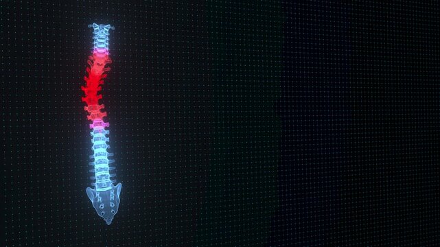 Endless 4k Video Curved Spine in Digital Visualization &ndash; Concept of Back Disorders and Postural Problems. ProRes 4444.