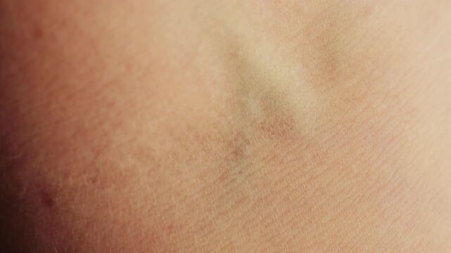 Hand skin texture. Macro shot of human veins. Body and health concept. High quality 4k footage