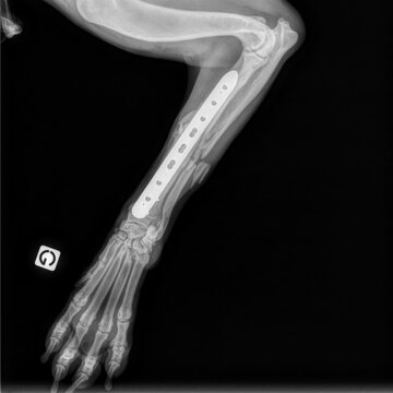 Pose d'une plaque viss&eacute;e sur une fracture du radius et de l'ulna chez un chien, vue de face