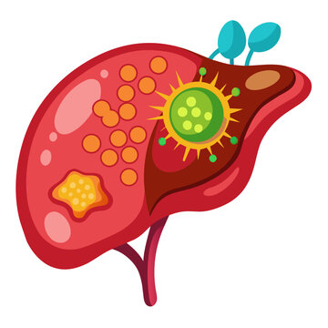 Cartoon liver cell infected with a virus