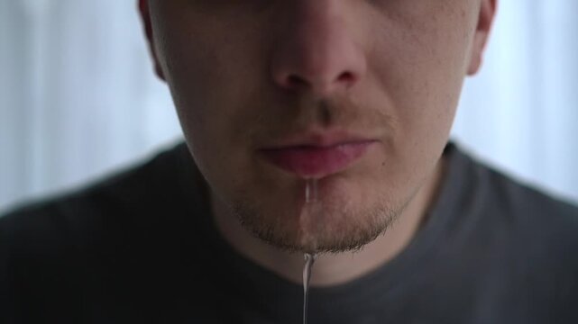 Man experiencing a sudden unwell condition with liquid dripping from his mouth, facial expression showing shock and distress. Indoor lifestyle scene focused on health issues and human reaction.
