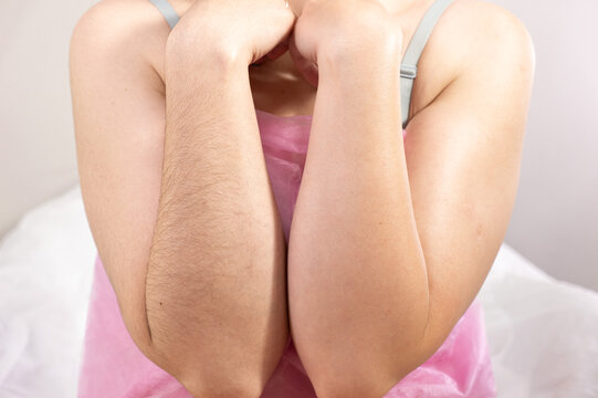 Paired forearms comparison before vs after wax depilation showing one smooth one hairy. Closeup contrast of textures. Concept of body hair and natural beauty