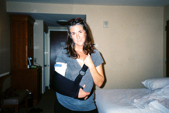 Film flash portrait of woman with injured arm in hotel room 