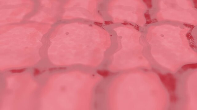 Skin Cells up Close on Human Dermis - Rosacea of Enflamed Psoriasis