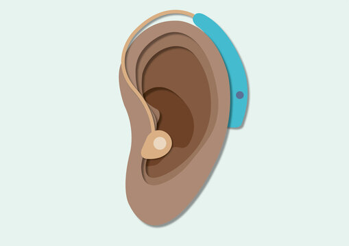 Hearing aid, conceptual illustration