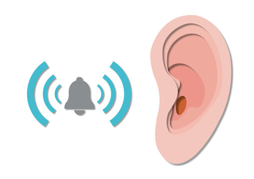 Tinnitus, conceptual illustration