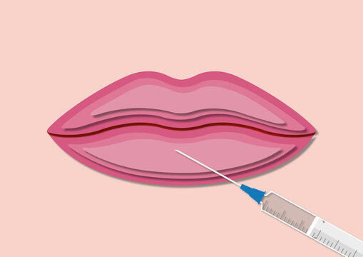 Botox injection, conceptual illustration