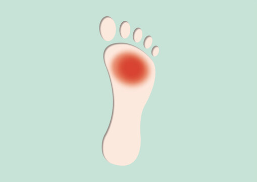 Neuropathy, conceptual illustration
