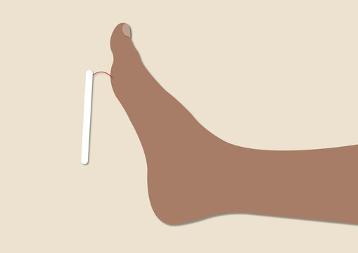 Monofilament test, conceptual illustration