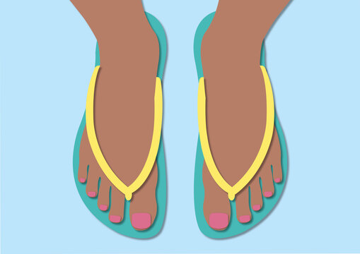 Bunions, illustration