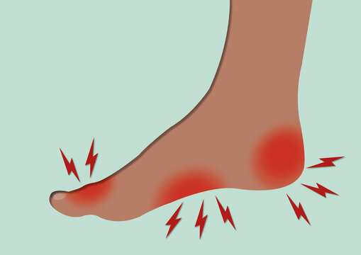 Foot pain, conceptual illustration
