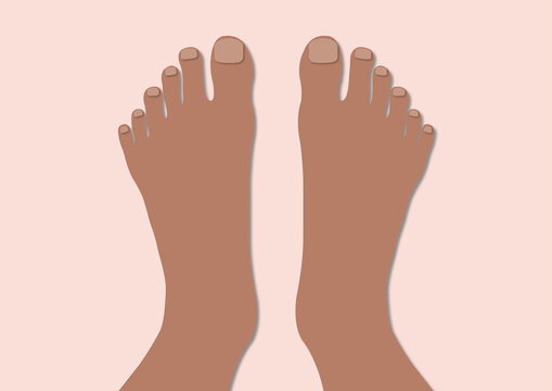 Polydactyl feet, conceptual illustration
