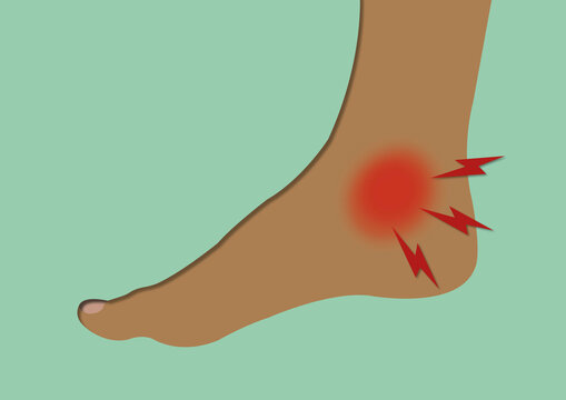 Ankle pain, conceptual illustration