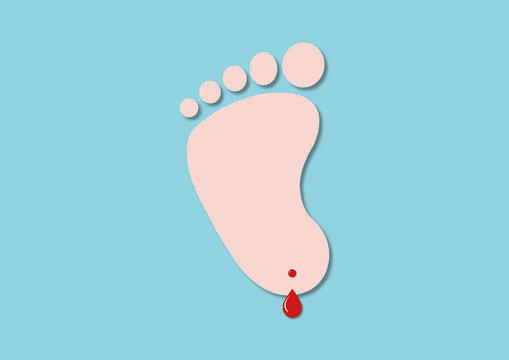 Heel prick test, conceptual illustration