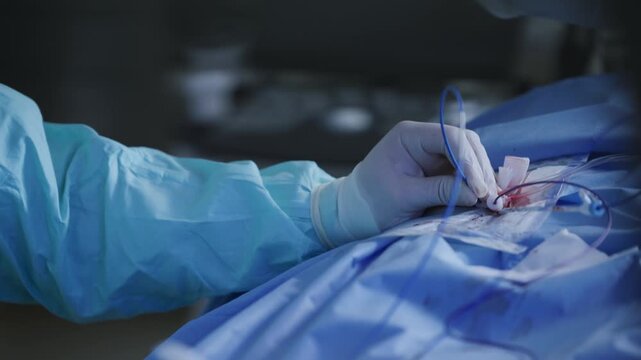 Closeup of cardiac catheterization procedure with surgeon hands and sterile drape. Doctor operates bypass in medical clinical.