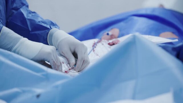 Closeup of gloved hands manipulating catheter and guidewire during cardiac catheterization procedure for interventional cardiology.