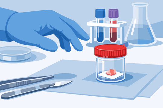 Vector illustration of a gloved hand reaching for a sterile container with a tissue sample in a lab, featuring test tubes, a flask, a scalpel, and tweezers for medical research and pathology.