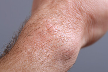 Fototapeta premium Ultra close up skin morning light glow natural pores skin close up macro forearm hair texture pore adult male healthy detail natural light skin tone dermatology epidermis hairy wrist arm skin care