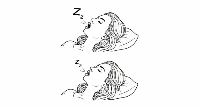 Two women sleeping with "Zz" symbols indicating snoring
