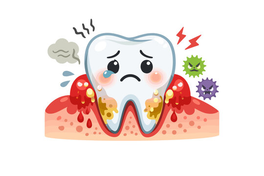 Gum Disease Cartoon Images &ndash; Browse 4,215 Stock Photos, Vectors, and Video  | Adobe Stock