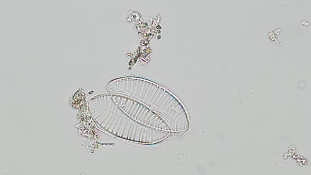 Coscinodiscus sp. diatom under brightfield microscope at 50x
