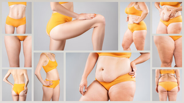 Female body shapes and types collage. Different women figures in underwear, weight loss, diet, cellulite and body positive concept