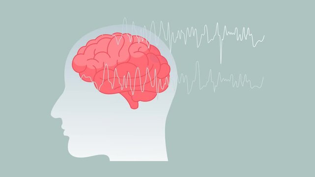 Epilepsy - A Neurological Condition - Stock Animated Illustration as MP4 File