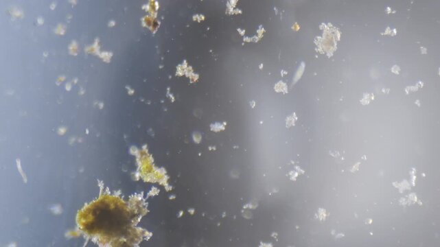 Microscopical view of water of a river with algae and microorganisms