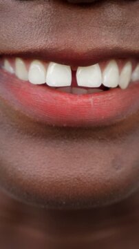 Closeup Black Smile Showing White Teeth, Gradual Sequence From Closed Lips To Broad Grin, Natural Warm Lighting, Dark Skin Texture, Subtle Chin Detail, Candid Joyful Expression, Oral Health Focus