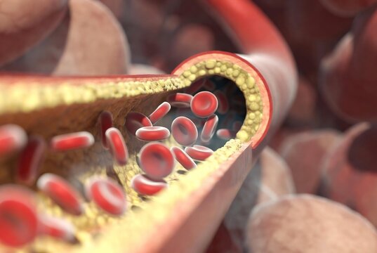 It depicts a cross-section of an artery with red blood cells flowing through it.