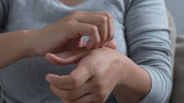 Dermatology, woman reaction from atopic, insect bites on her arm, hand in scratching itchy or rash of skin, treatment of beauty. Healthcare and medical concept.