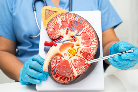Chronic kidney disease, Asian woman with model for treatment urinary system, urology, Estimated glomerular filtration rate eGFR.