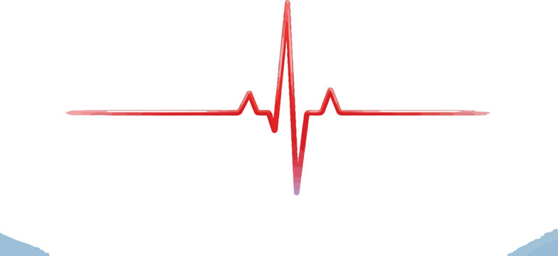 Electrocardiogram waveform displaying a normal heartbeat rhythm pattern