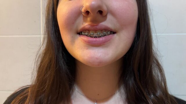 Detalle de la boca de una chica con brackets sonriendo