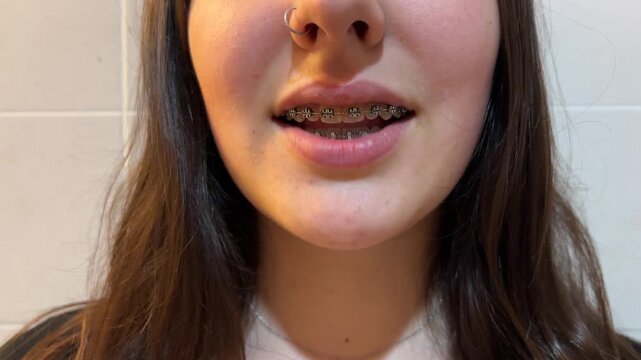 Detalle de la boca de una chica con brackets hablando