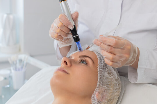 Middle-aged woman girl undergoes facial rejuvenation using dermapen microneedling technique. Cosmetologist performs fractional mesotherapy procedure in beauty clinic to improve skin texture and health