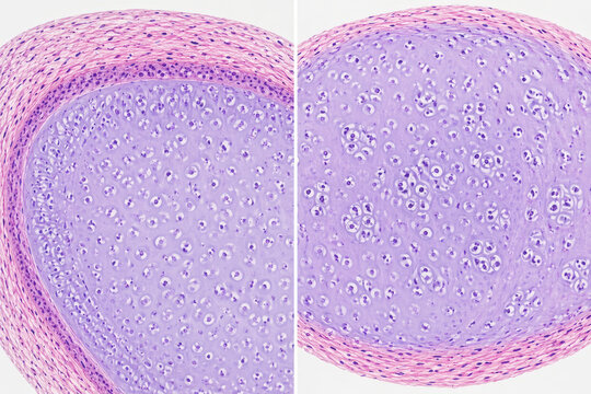 Appositional vs Interstitial Growth of Cartilage Histology
