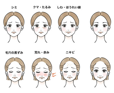 肌年齢、肌トラブルに悩む女性の顔のイラストセット