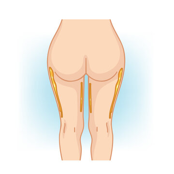 Slim and Well-Proportioned Thighs