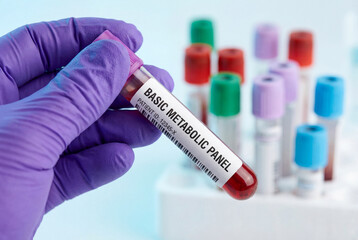 Naklejka premium Scientist holding a blood sample for a basic metabolic panel test in a medical laboratory