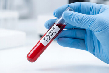 Obraz premium Norovirus positive blood sample in a test tube held by a medical professional in a lab
