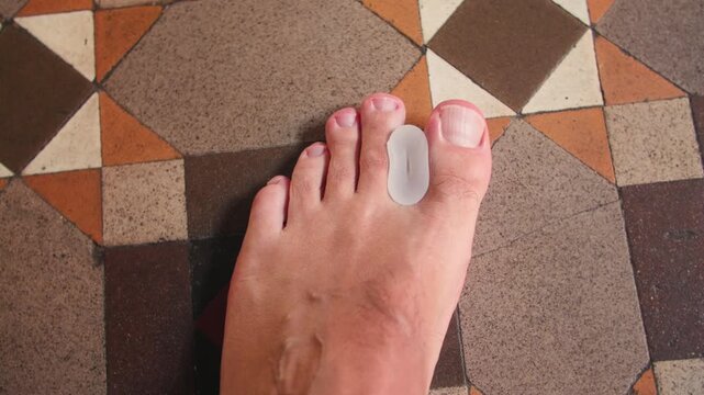 Close-up shot of a human foot with a silicone toe separator placed between the toes. The footage highlights foot care, hygiene, and wellness routines. High quality 4k footage