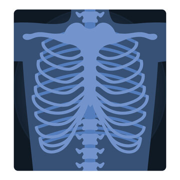 Medical xray scan of human chest. Medical skeleton test, body radiography cartoon vector illustration