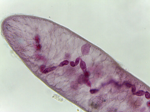 Spirostomum Giant Ciliate Protozoan Anterior End Light Microsc