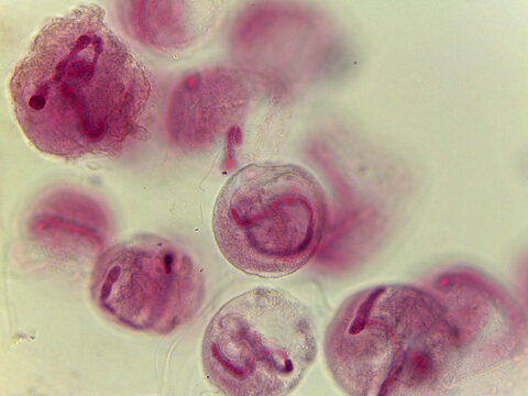 Vorticella Bell-Shaped Ciliate Colony Cluster Light Microscopy Spe