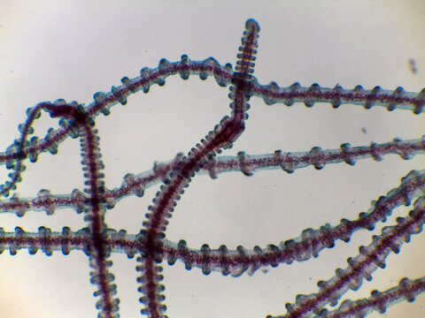 Gonionemus Jellyfish Velum Balancing Organ Tentacle Detail Light Microscop