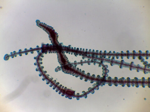 Gonionemus Jellyfish Velum Balancing Organ Tentacle Detail Light Microscop
