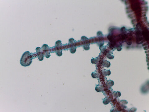 Gonionemus Jellyfish Velum Balancing Organ Tentacle Detail Light Microscop