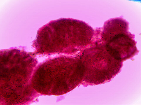 Obelia Hydroid Colony Gonangia Medusa Buds Branching Stem 