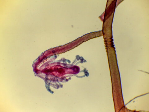 Pennaria Hydroid Gastrozooid Polyp Tentacles Stem Detail Light Microsc